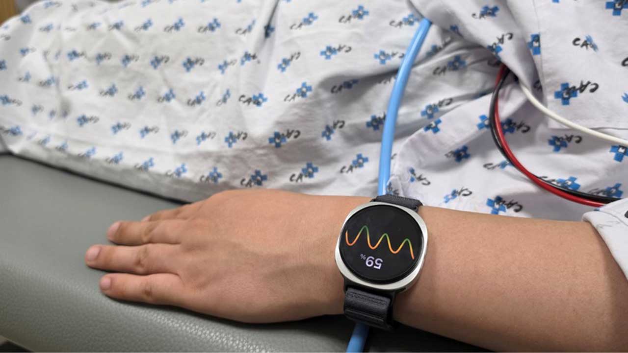 galaxy watch ai can now predict fainting episodes 1