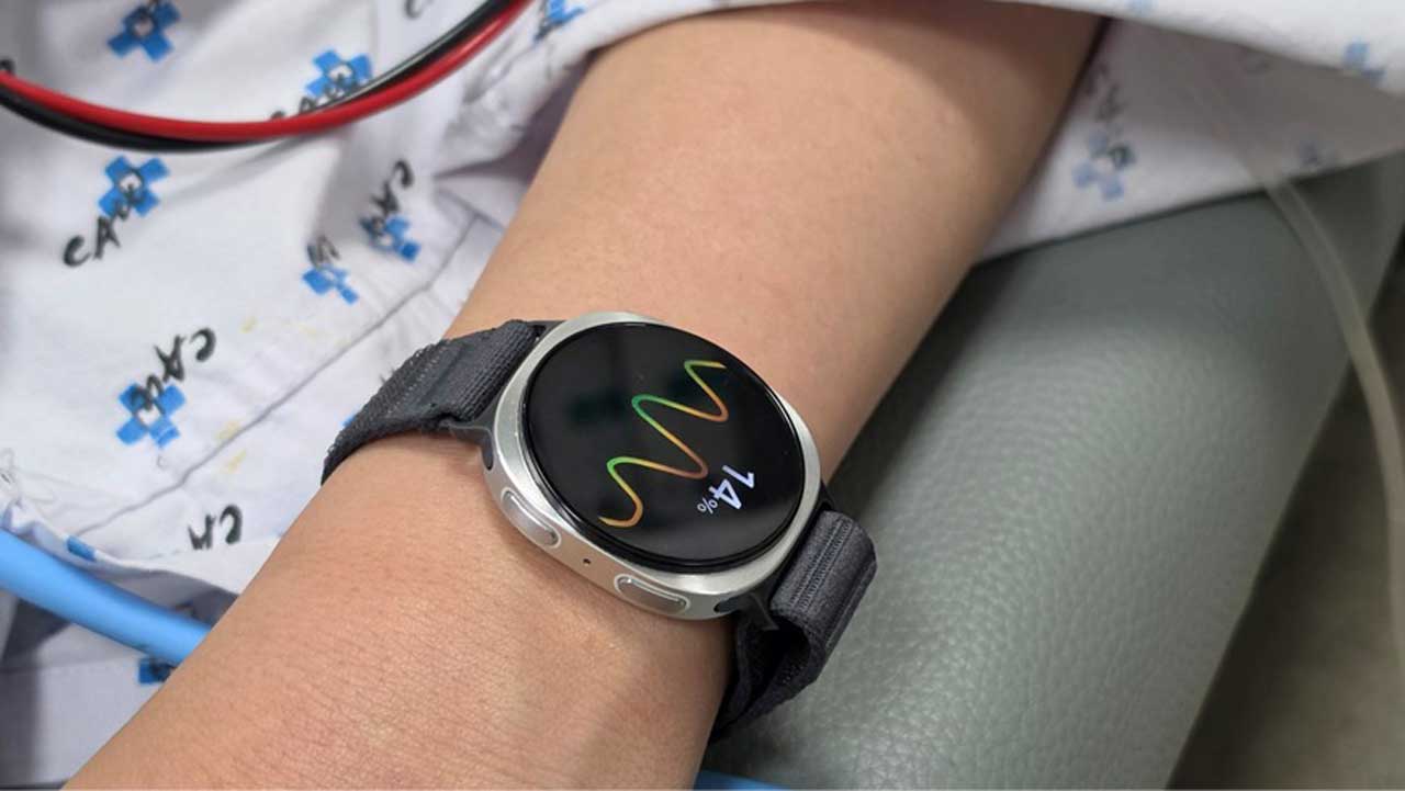 galaxy watch ai can now predict fainting episodes 2